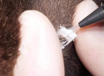 Cryosurgery for Dogs and Cats: An Alternative Option for Treating Lesions and Tumors